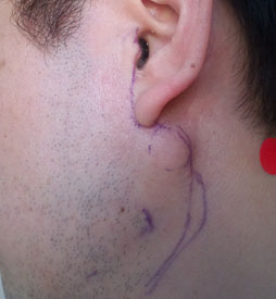 ���������꡼ No.011�Υ���ͥ������ / ���������ʡۼ���Ŧ�м�Ѥ�����Ƽ��餬�Х����ϥ��������ˤʤä���