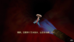 ���������꡼ No.004�Υ���ͥ������ / ��Ĳ����������ţ����ʤɤ�����ȥܥǥ��ۥ顼������ɡ�Revenge Of The Colon��12��23��ȯ��